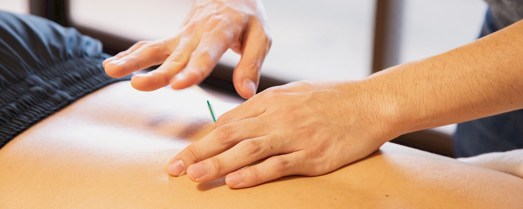 What Does Acupuncture Feel Like? A First Visit Guide